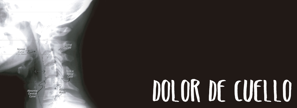 Dolor de cuello