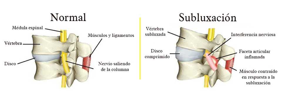 Quiropraxia Centro - Barroso